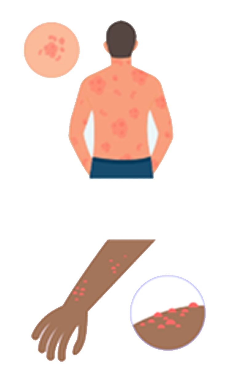 A graphic image showing symptoms